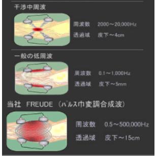 ボディ・フェイスケア FREUDE-mini Amazon | FREUDE-mini フロイデミニ 本体セット×1台（専用粘着