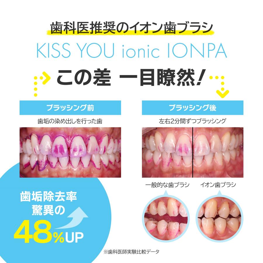 SEAL限定商品】 アイオニック KISS YOU 音波振動歯ブラシ IONPA DM-011 本体 レッド 1個