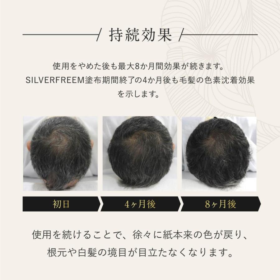 白髪ケアセラム 3セット 白髪ケア 頭皮ケア エイジングケア 天然由来