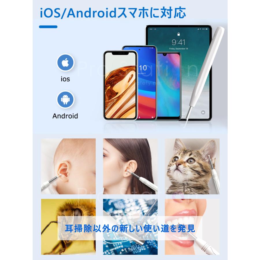 耳かき カメラ 極細 USB充電 WIFI接続 イヤースコープ 無線 LEDライト付き IP67防水 耳掃除 耳鏡 耳垢クリーニング iphone＆Android対応 使用簡単 1ヶ月保証 |  | 06