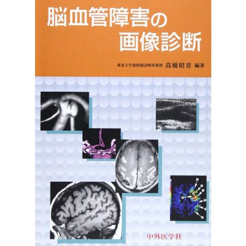 堅実な究極の 脳血管障害の画像診断 放射線診断学、核医学