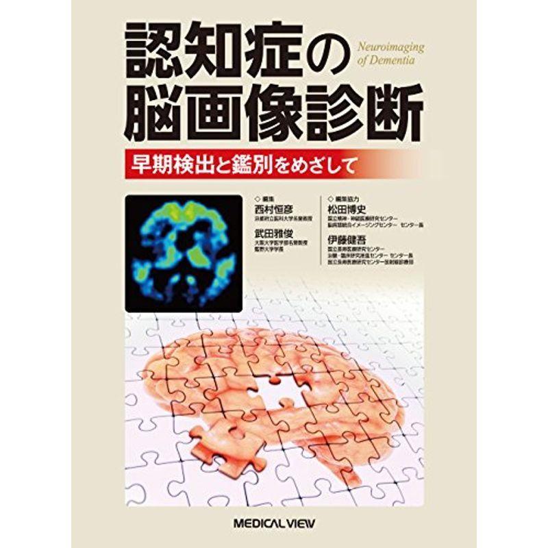 認知症の脳画像診断 早期検出と鑑別をめざして 放射線診断学 核医学 Www Igrossisti Eu