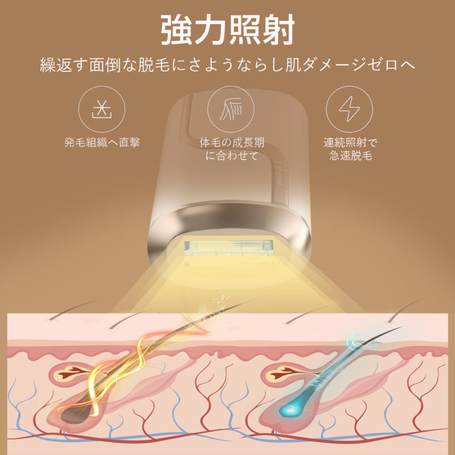 脱毛器 自宅 VIO対応 敏感肌も使えるIPL光脱毛器 だつもうき ヒゲムダ