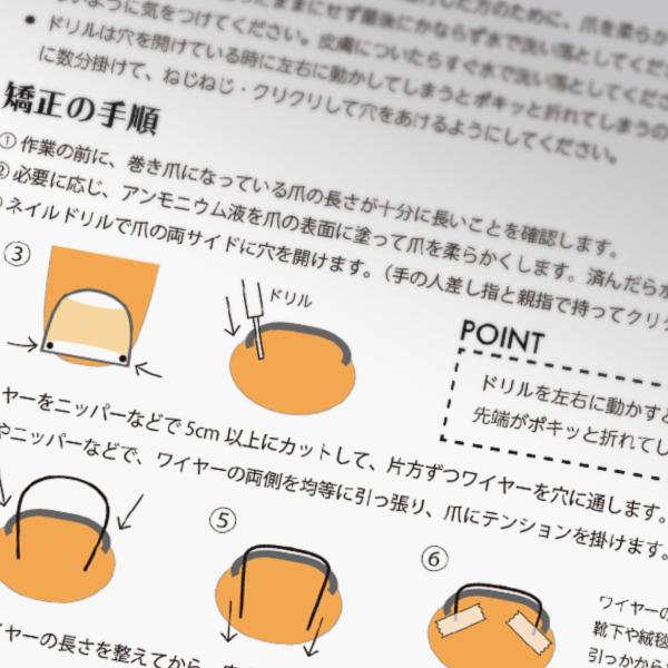 【巻き爪ケア】ワイヤー矯正マニュアル 巻き爪ワイヤー矯正法 セルフケアキット : 巻き爪セルフケア・ヘルシー
