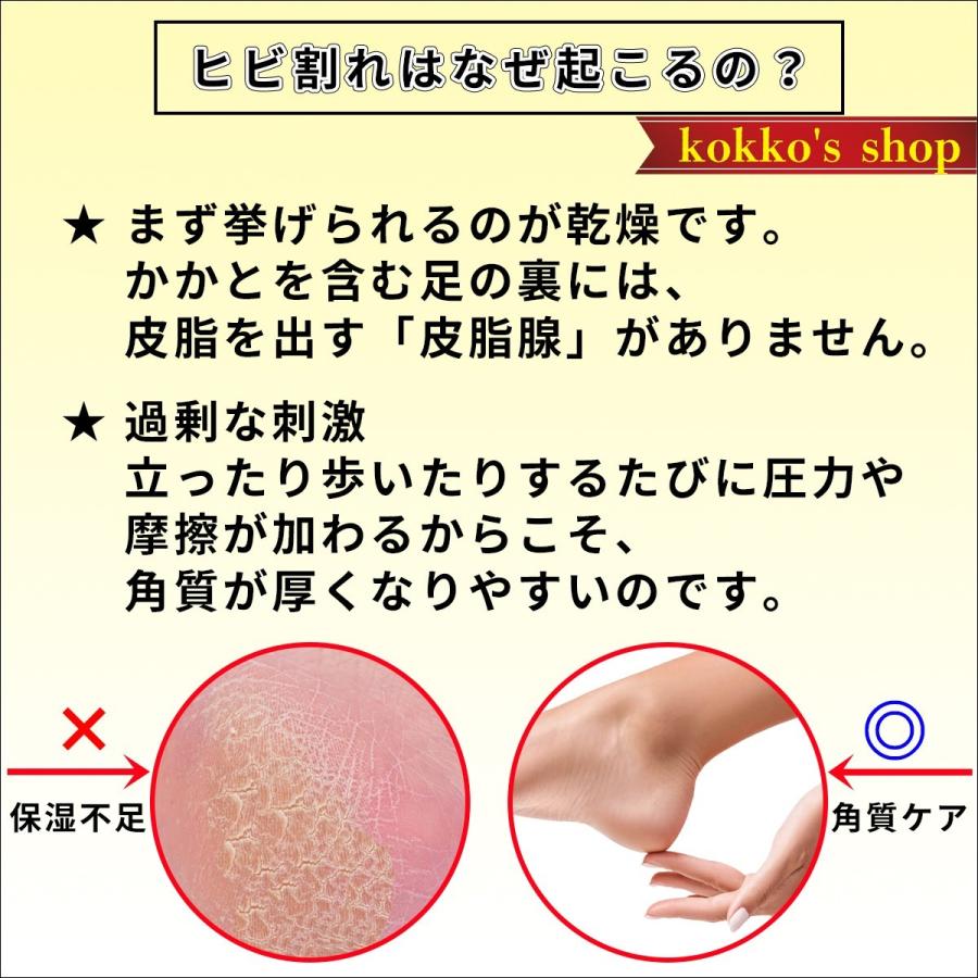 かかと 角質ケア サポーター カカト 痛い 踵 ひび割れ 割れ ガサガサ 剣道 足底筋膜炎 かかとケア かかと痛い |  | 02