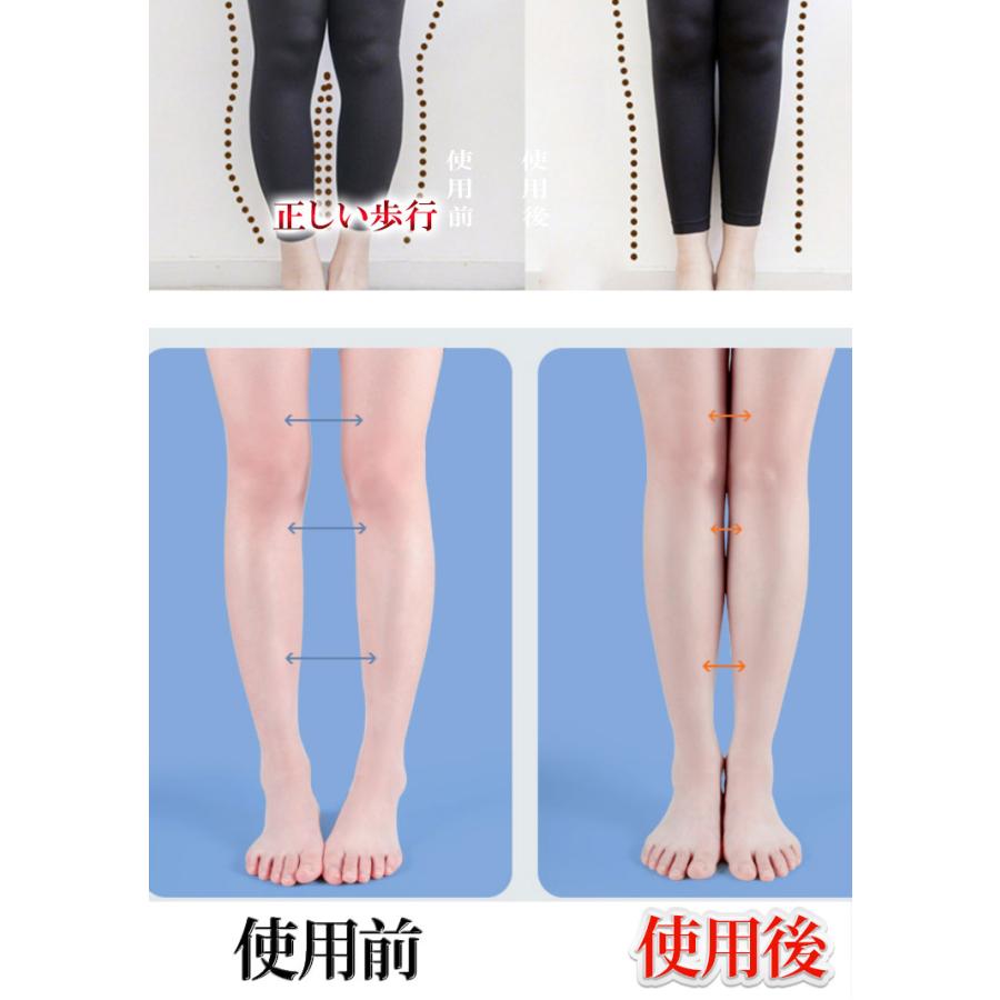 土踏まず アーチサポーター 矯正 扁平足 X脚 ダークグレー L 2足 専用 矯正 足裏 土踏まず 扁平 扁平足 アーチ サポート