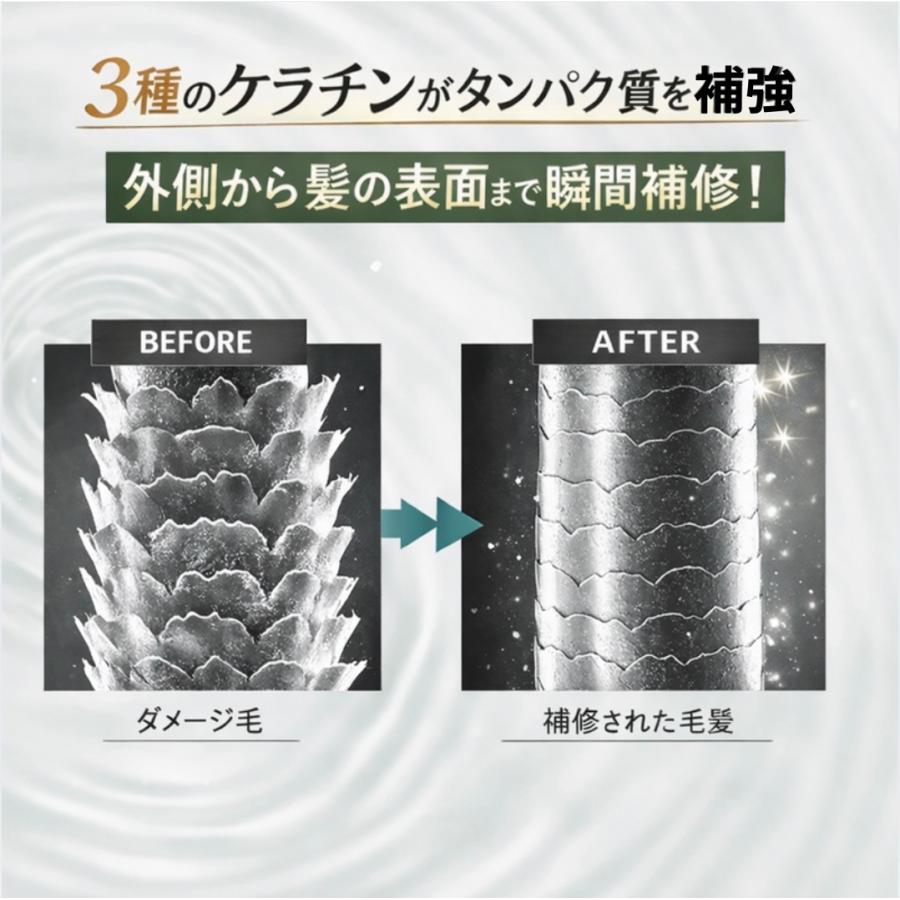 梨花プロデュース⭐︎アクニーシャンプー&トリートメント Amazon | AKNIR アクニー 【濃密薬用処方】 シャンプー 梨花 監修 泡