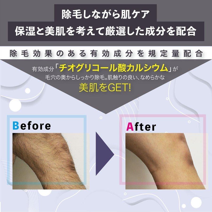 除毛クリーム SP REMOVE エスピーリムーブ 1本 除毛 すべ肌 ケア