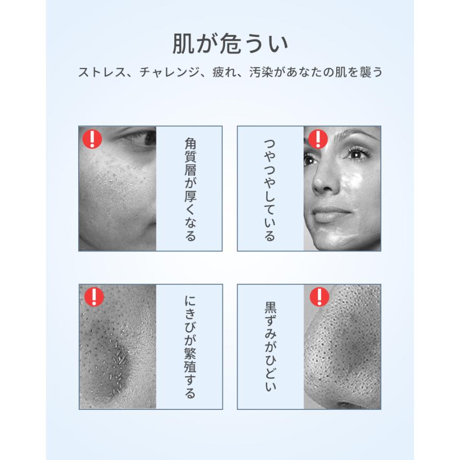 ウォーターピーリング 美顔器 ブリリアントピール 毛穴 超音波 日本製 楽天市場】ウォーターピーリング 美顔器 ブリリアントピール