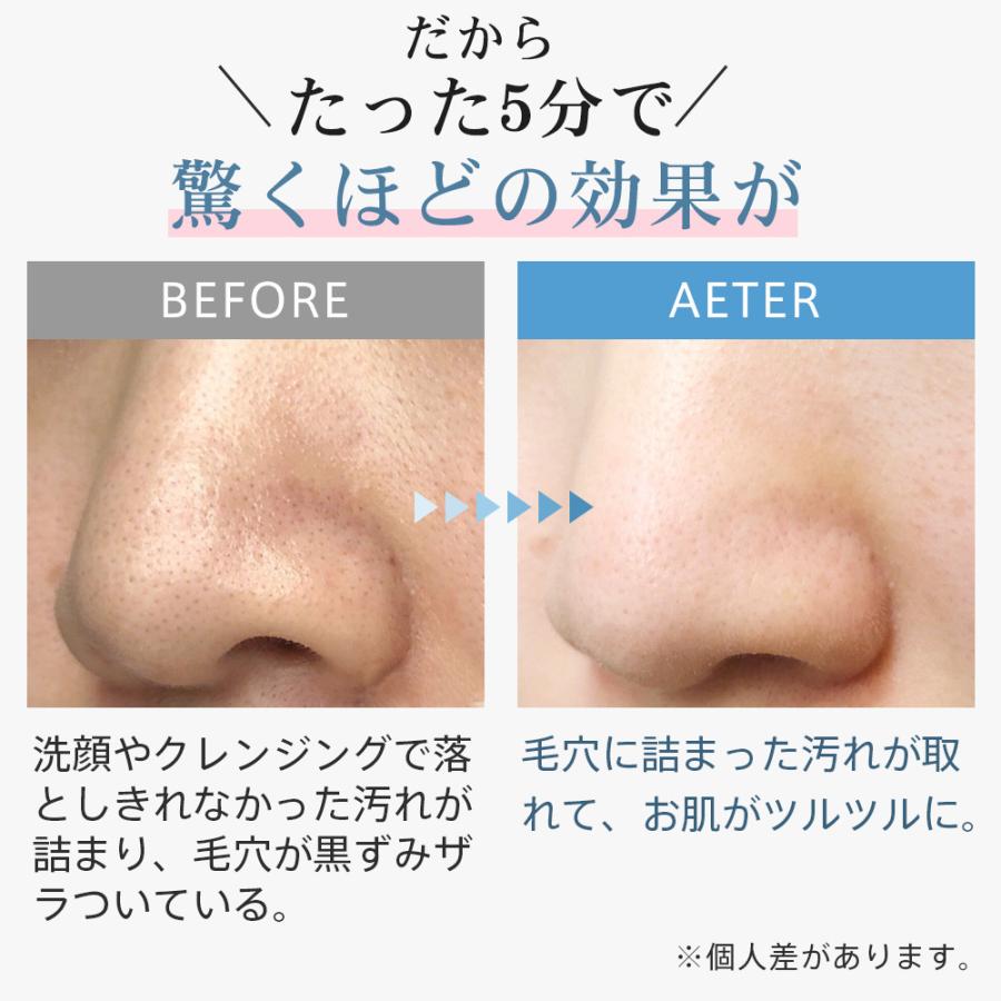 iFusion ウォーターピーリング 美顔器 毛穴ケア 超音波ピーリング