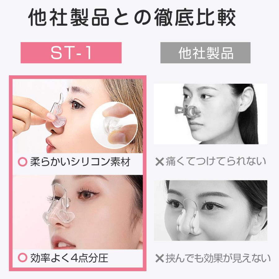 ノーズクリップ 鼻筋セレブ 美鼻矯正器具 シリコン チタンアーム 鼻クリップ 鼻挟み 美鼻 鼻 鼻痩せ 鼻筋矯正 団子鼻 豚鼻 小鼻に適用 補正 洗い可能 使用簡単 Mbjst1tmzi Kousyo Store 通販 Yahoo ショッピング