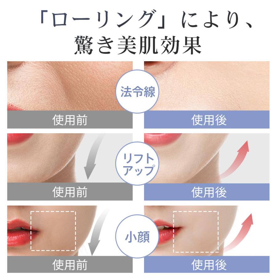 「SGS認証済み」美顔ローラー マイクロカレント 美顔器 美容ローラー リフトアップ ほうれい線 フェイスローラー ボディローラー Y字型 ミニ 防水 充電不要 | ブランド登録なし | 12