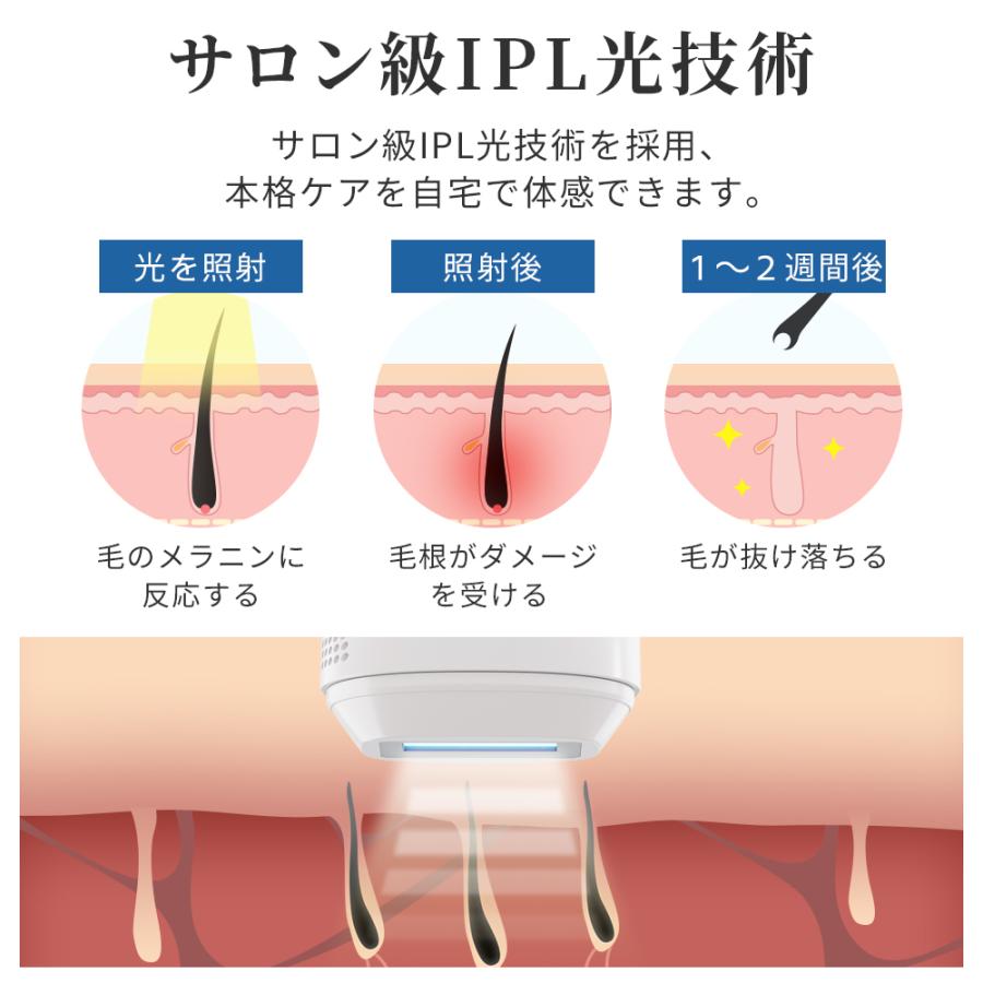 脱毛器 サファイア脱毛器 フラッシュ IPL脱毛器 光脱毛器 家庭用脱毛器 サファイア冷却技術 3in1 美容器 肌検知センサー搭載 エステ 自動照射 9段レベル｜kousyoustore｜06