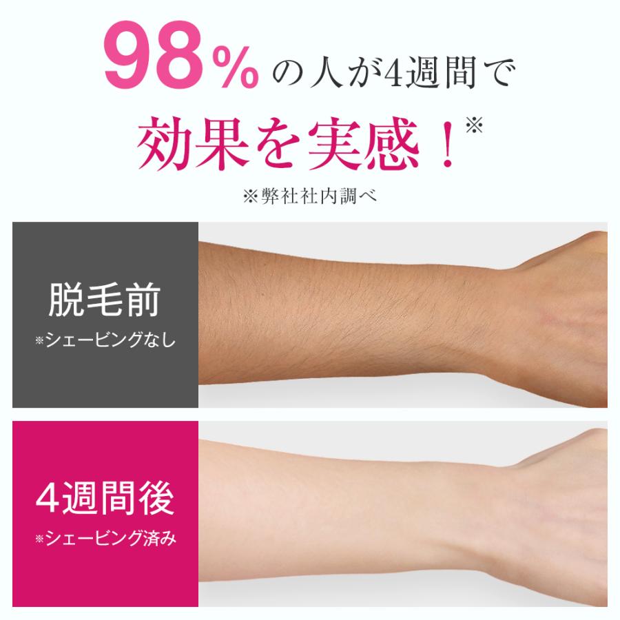TAKUYO 脱毛器 5段階レベル 家庭用脱毛器 HIPL 痛くない 光脱毛 TAKUYO 脱毛器 5段階レベル 家庭用脱毛器 HIPL 痛くない 光脱毛