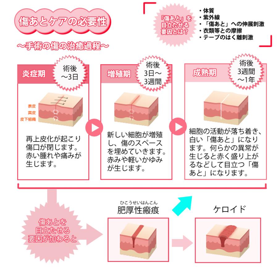 アトファイン Lサイズ 6枚入 : ケーズストア Yahoo!店 - 通販 - Yahoo