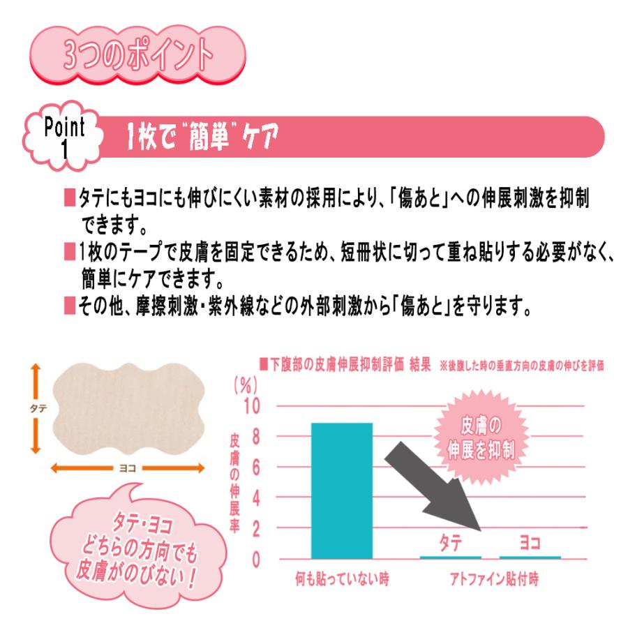 アトファイン Lサイズ 6枚入 : ケーズストア Yahoo!店 - 通販 - Yahoo