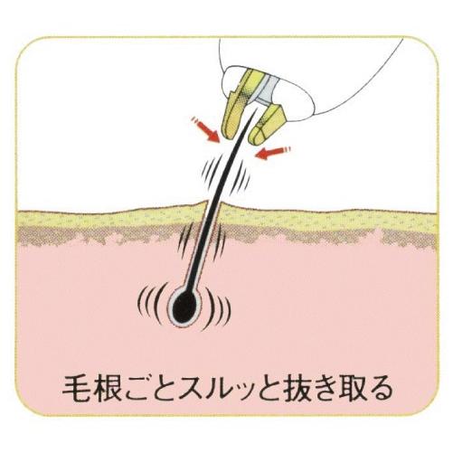 BRAUN（ブラウン） 高周波脱毛機 エムジョイ フェイシャルビューティ