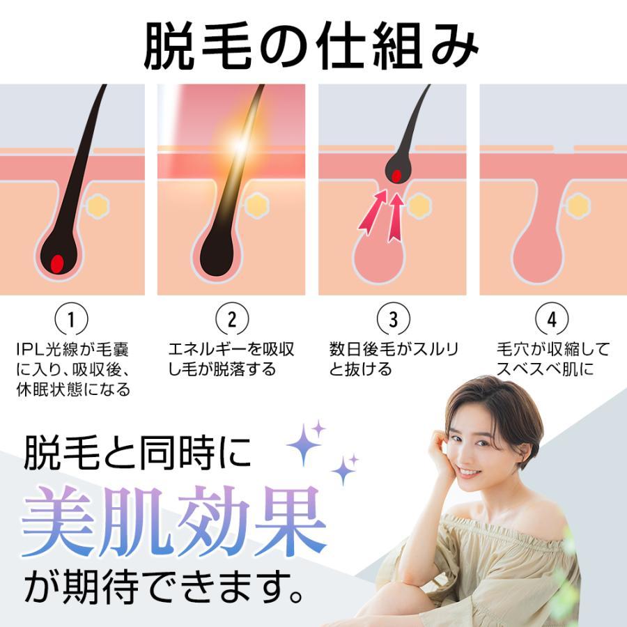 Shammah フラッシュ脱毛器 楽天市場】【5000円OFFクーポン】 脱毛器 照射回数無限 【2年