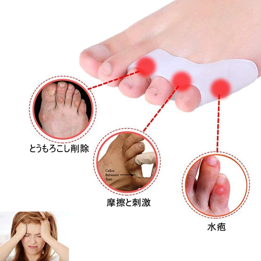 内反小趾 サポーター 足指分離パッド 矯正 水疱 摩擦 痛み 10個入 B07sjrcyfj Kumagai Online Shop 通販 Yahoo ショッピング