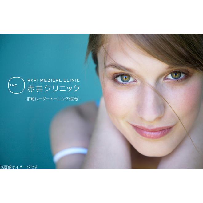 21年レディースファッション福袋 男女ｏｋ 表参道 肝斑レーザートーニング Q Yag 5回 透明感のある美肌に シミ 健康 医療 特集30 0 トーニング 美容クリニック サービスクーポン 引換券 Marrakesh Co Il