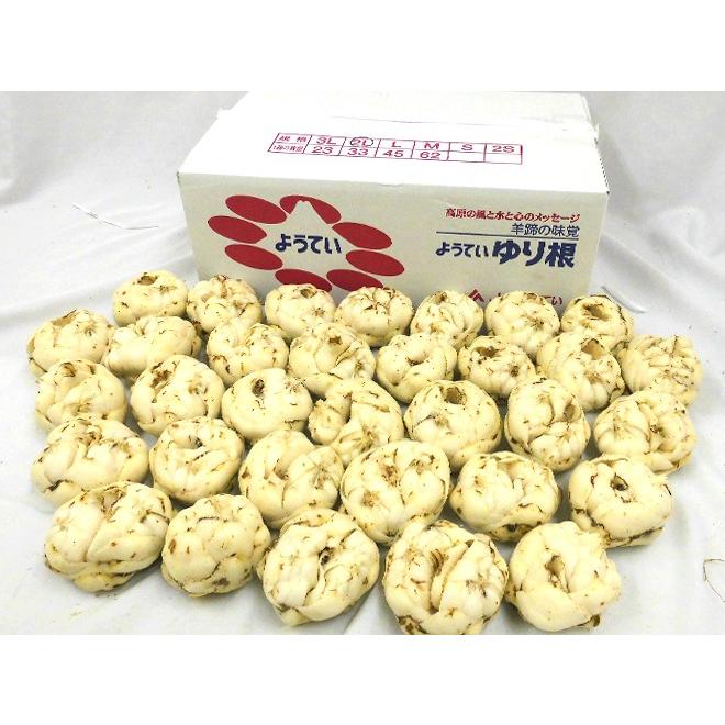 北海道産 ゆり根” ちょっと訳あり 33〜45玉 約5kg ゆりね【予約 11月
