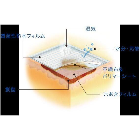 白十字 モイスキンパッド（滅菌済）7510 7.5×10cm 60袋入×8箱