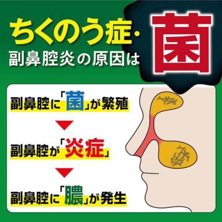 第2類医薬品 チクナインC 点鼻スプレー 30ml 点鼻薬 ちくのう症｜kurasio-en｜06