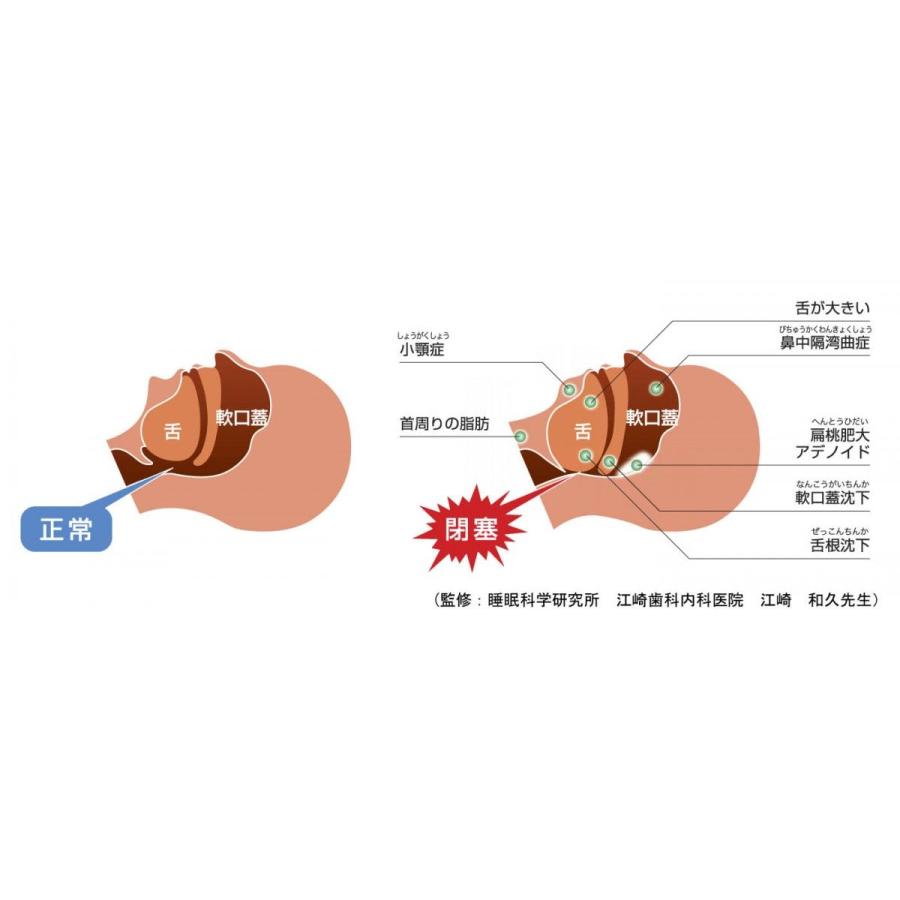 横向き寝支援用腰枕 :4952180730016:くら助 - 通販 - Yahoo!ショッピング 横向き寝支援用腰枕 :4952180730016:くら助 - 通販 - Yahoo!ショッピング