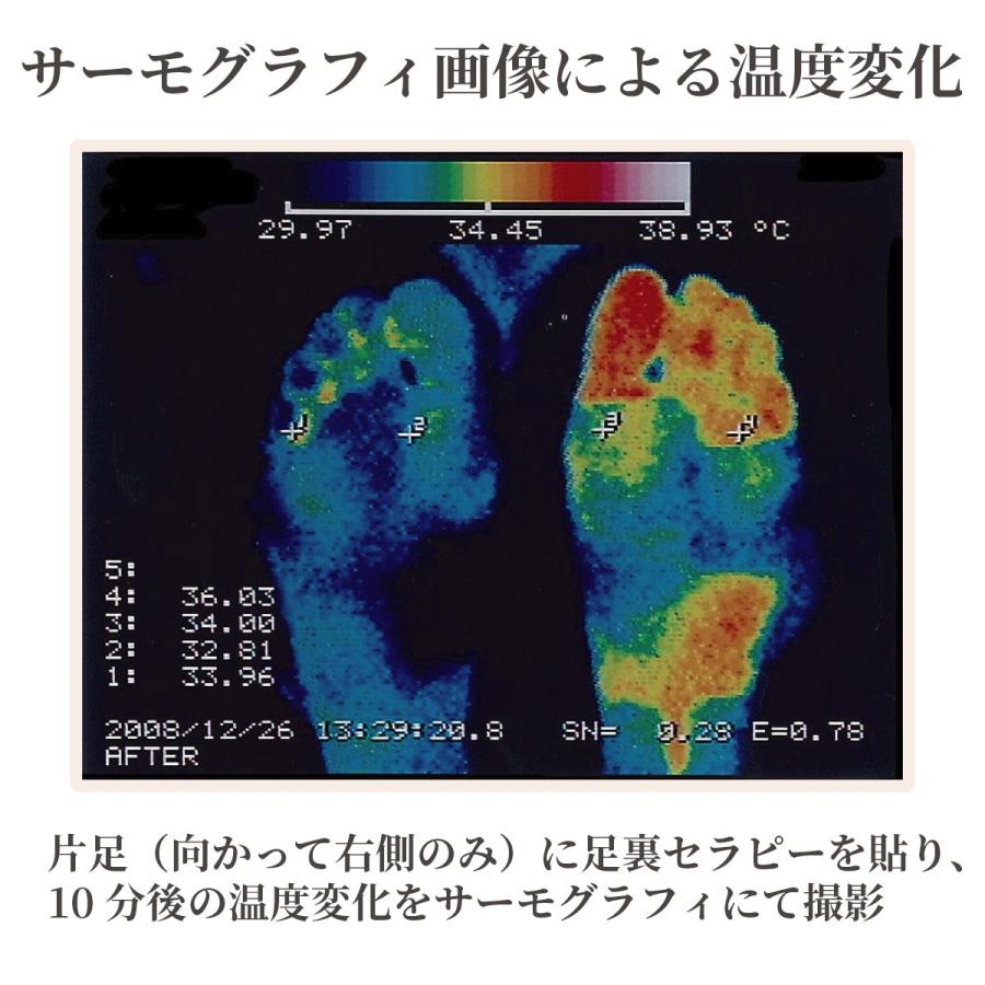 芦原式 足裏セラピー メタルシール（84枚入り）1個｜kurazo｜04