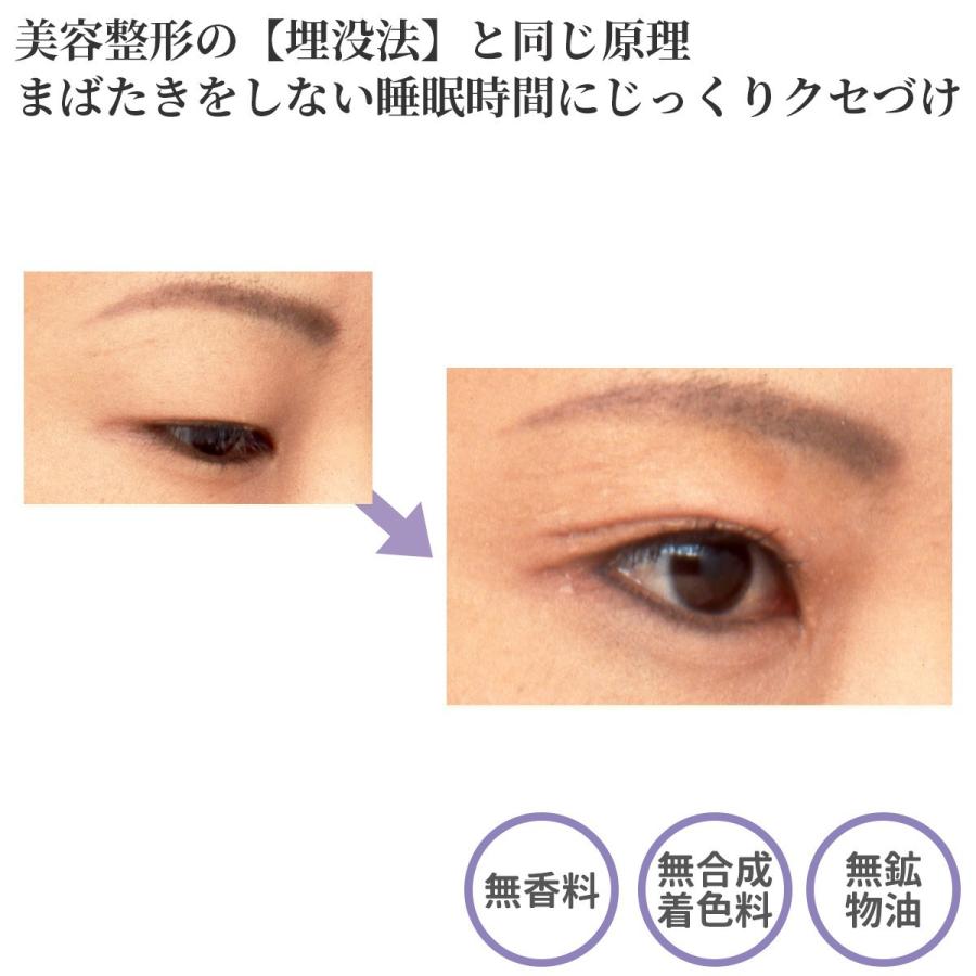 Tommy Rich（トミーリッチ） 二重 癖付け 夜 アイエッポ・ナイト‐夜用