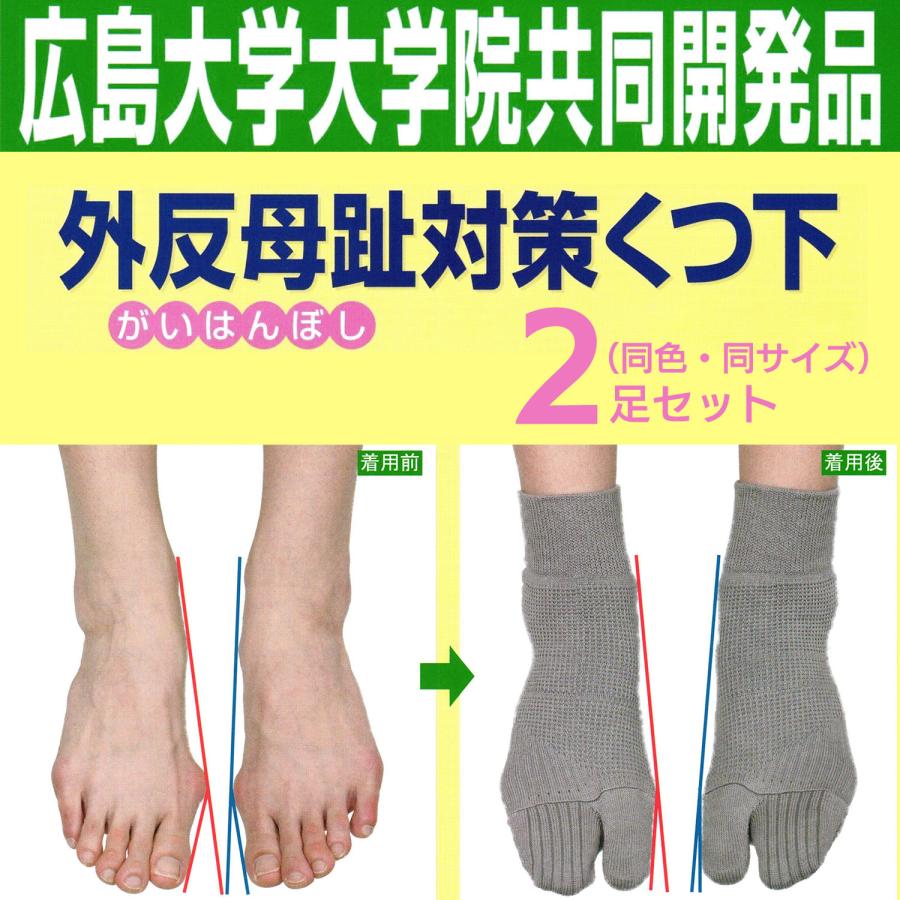 外反母趾予防セット 4セット コーポレーションパールスター 2足セット 外反母趾対策 くつ下 靴下‐蘭