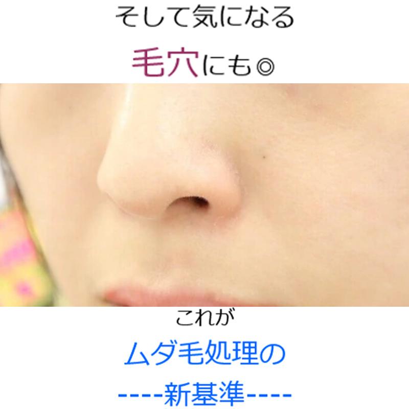 ムダ毛 抑毛 毛穴 エピシャイン 100ml ローション デリケートゾーン ムダ毛ケア 脱毛 除毛 ヒゲ :F132EPISHINE001:La luna - 通販 - Yahoo!ショッピング ムダ毛 抑毛 毛穴 エピシャイン 100ml ローション デリケートゾーン ムダ毛ケア 脱毛 除毛 ヒゲ :F132EPISHINE001:La luna - 通販 - Yahoo!ショッピング