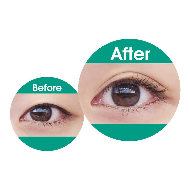 プリュドール セパレート 30組 二重まぶたにする方法 二重 アイプチ アイプチテープ シール 04 0029 Lalume 通販 Yahoo ショッピング