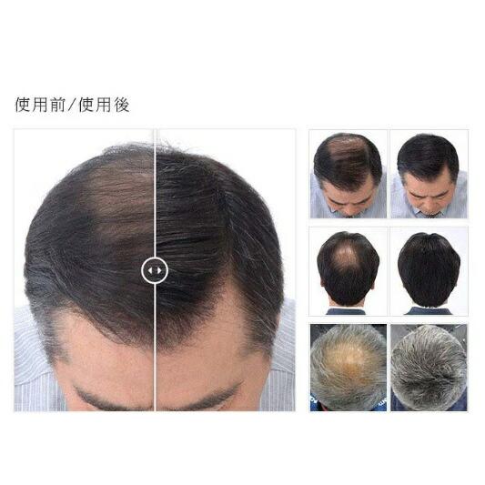 3セット  スーパーミリオンヘアー ダークブラウン 30g  増毛 人口毛 パウダー 視覚 薄毛 コンプレックス 男性 女性 雨 風 汗の画像