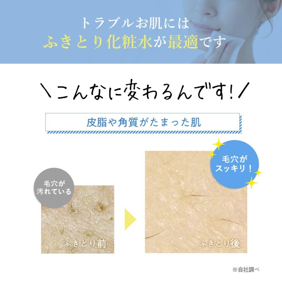 コットンプレゼント 毛穴 黒ずみ 拭き取り ふき取り 化粧水 Aha ピーリング 角質ケア ふき取り化粧水 ニキビ 角栓 くすみ 鼻 ふきとり化粧水 ランテルノ 3本 Ha 3 Lantelno公式store 通販 Yahoo ショッピング