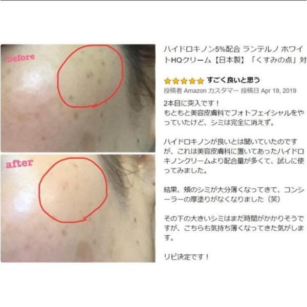純ハイドロキノン 5 配合 クリーム ハイドロキノン レチノール ビタミンc誘導体 Apps 美白 シミ 取り シミ 消し ランテルノ ホワイトhqクリーム 1本 Hq 1 Lantelno公式store 通販 Yahoo ショッピング