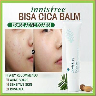 innisfree for acne scars