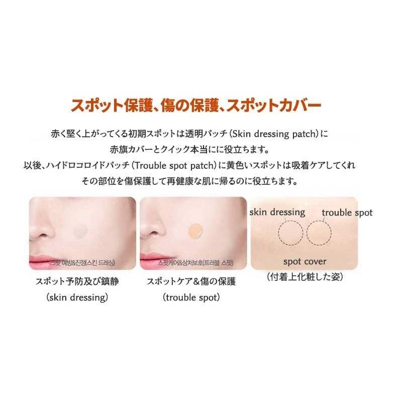 メディヒール ディスパッチ バイオ ドレッシング ポー スポットキット 80枚 ニキビパッチ アクネパッチ H1326 H1326 ラ プランタンヴァン 通販 Yahoo ショッピング