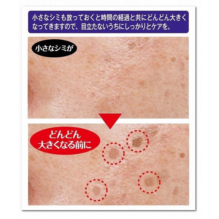 シミ取り パック そばかす 黒ずみ 美白 ナイトクリーム 効果 メラニン対策 男性 薬用 シミダスパック 30g 医薬部外品 送料無料 N Ns R001 Lash Premium 通販 Yahoo ショッピング