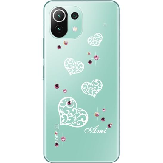 Mi Xiaomi 11 Lite 5G ケース シャオミ M11ライト カバー ライン