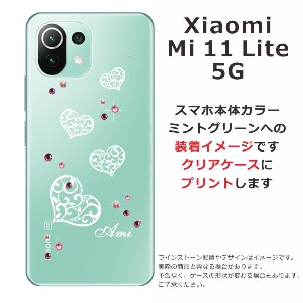 Mi Xiaomi 11 Lite 5G ケース シャオミ M11ライト カバー ライン 