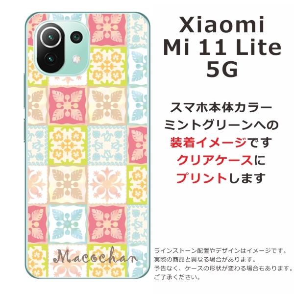Mi Xiaomi 11 Lite 5G ケース シャオミ M11ライト カバー らふら 名