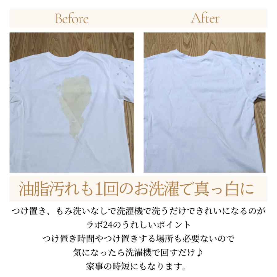 シャツ の 脇 の 黄ばみ