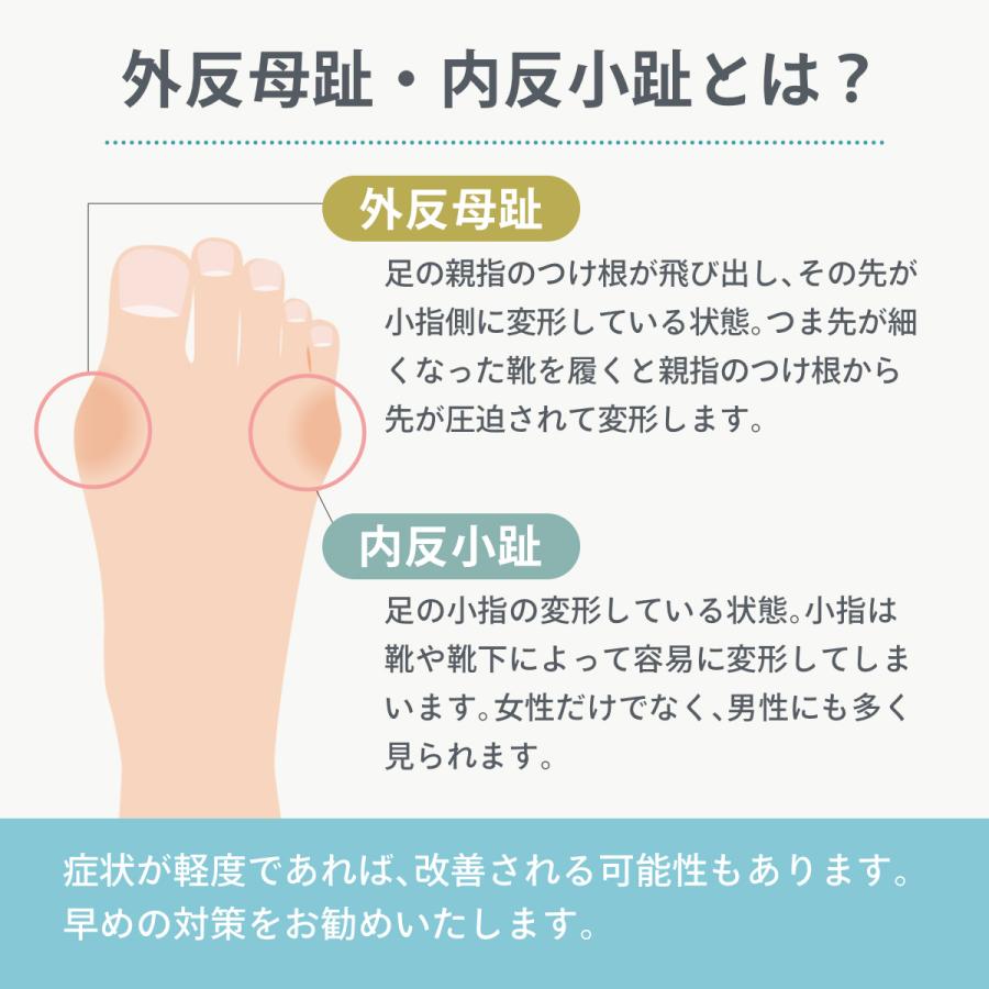 外反母趾 サポーター 内反小趾 矯正 シリコン 衝撃吸収 クッション 足指保護 足 指 痛み |  | 10