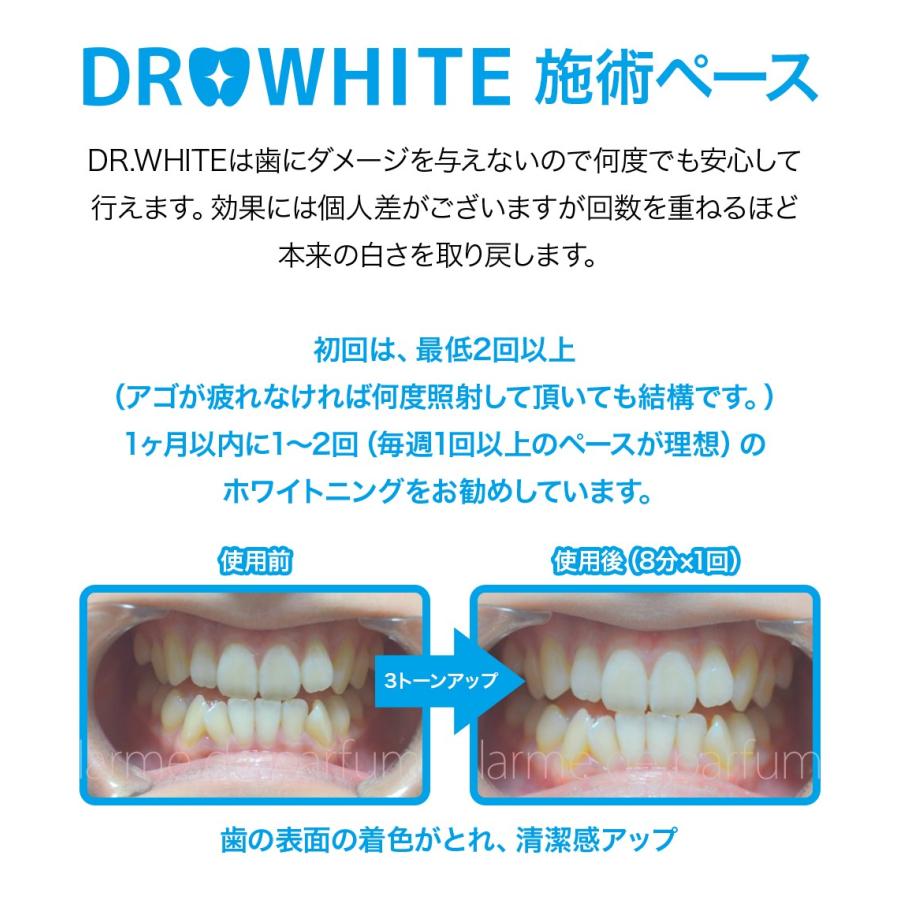 ホワイトニング キット セルフ 自宅 マウスピース 歯 LEDライト DR.WHITE(ドクターホワイト) スマホで簡単 ホワイトニングジェル セット(約15回) 歯磨き粉｜ldp｜19