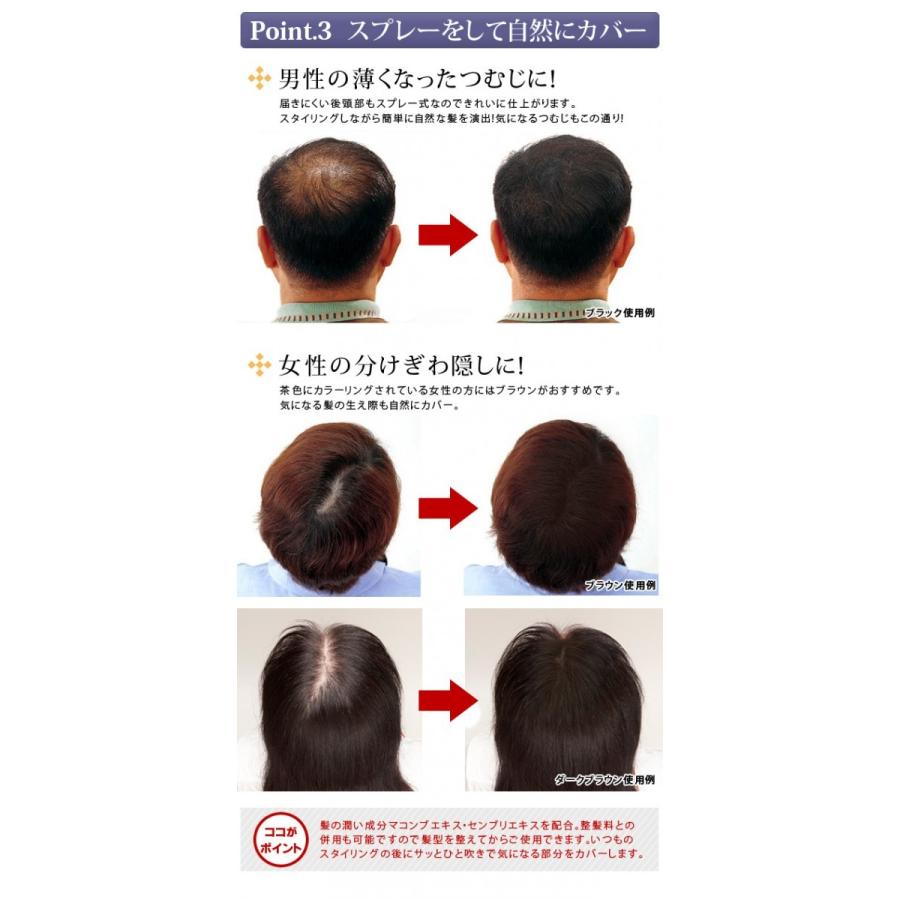 日本全国 送料無料 Newヘアフォロー ブラウン 正規品 生え際 つむじはげ 分け目部分 薄毛をカバー はげ隠しスプレー Aynaelda Com