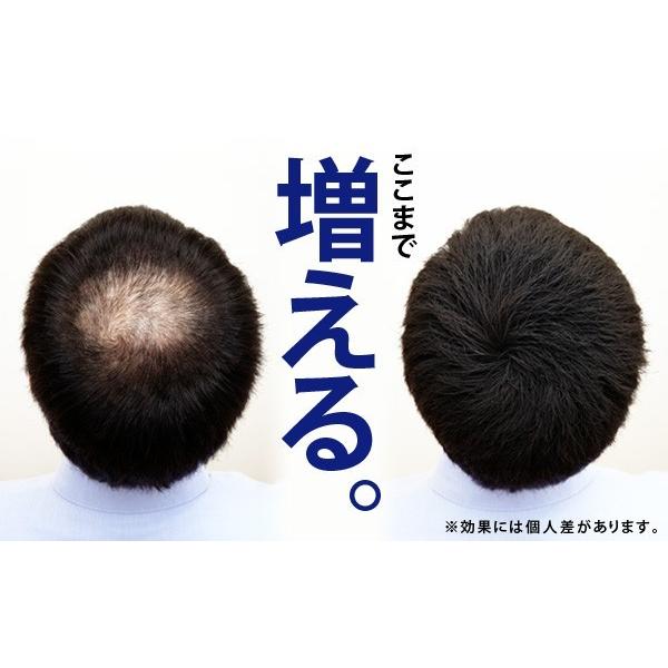 増毛スプレー newヘアフォロー ブラック 正規品 薄毛隠し 髪のボリュームアップスプレー｜le-cure｜06