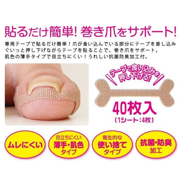 巻き爪テープ 巻き爪 ケア テープ 40枚入 巻き爪対策 グッズ 巻爪 保護 シール 巻き 爪 予防 絆創膏 フットケア 日本製 | アイメディア | 02