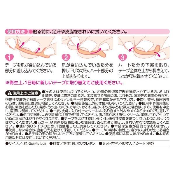 巻き爪テープ 巻き爪 ケア テープ 40枚入 巻き爪対策 グッズ 巻爪 保護 シール 巻き 爪 予防 絆創膏 フットケア 日本製 | アイメディア | 03