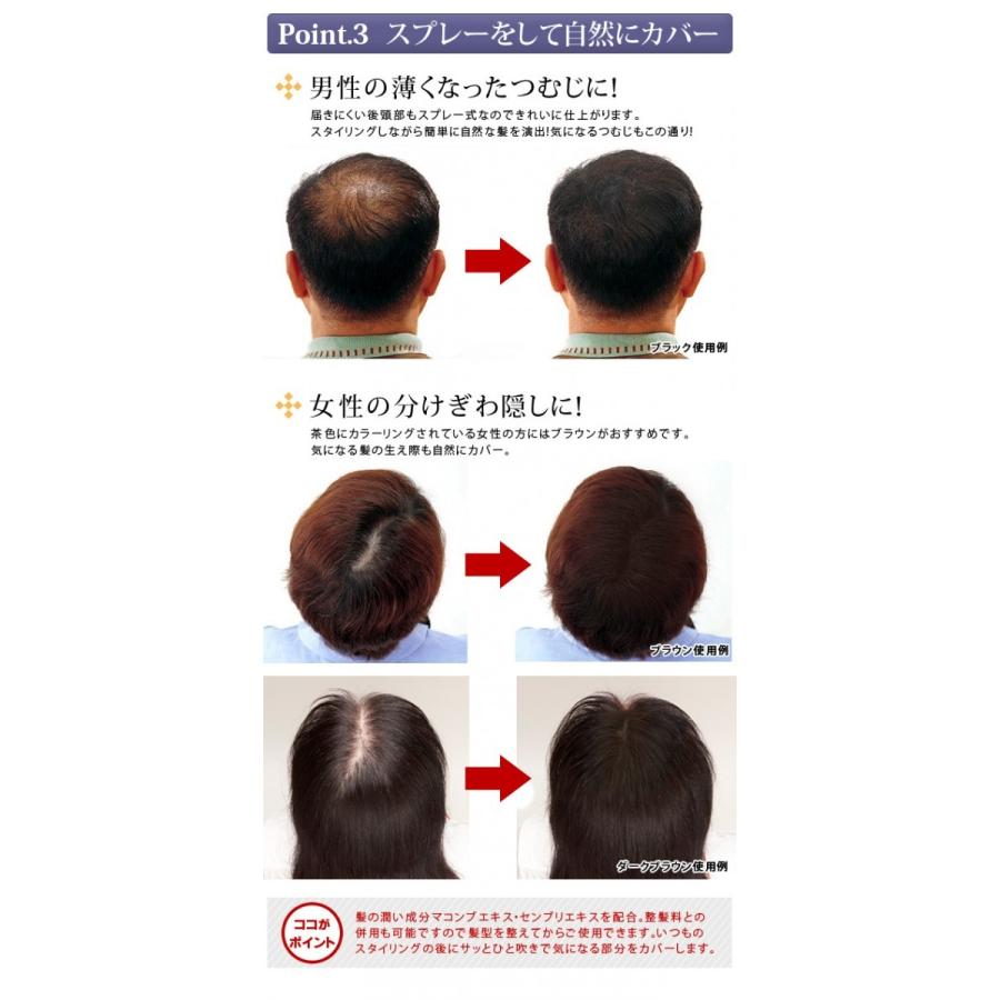 ヘアフォロー ダークブラウン 正規品 生え際 つむじはげ 分け目 薄毛を